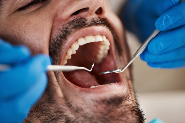 Best Tooth Infection Emergency Dentist  in Marion, MT
