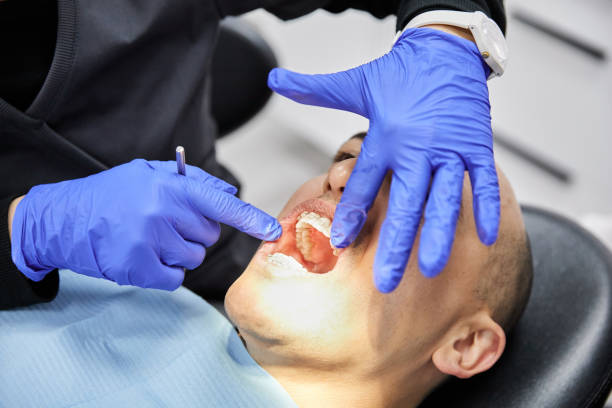 Best Emergency Tooth Extraction  in Marion, MT