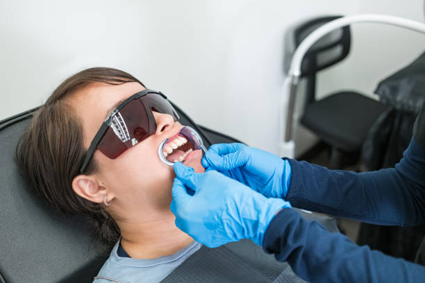 Teeth Whitening in MT